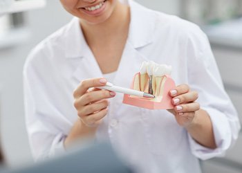 a dentist holding a dental implant model