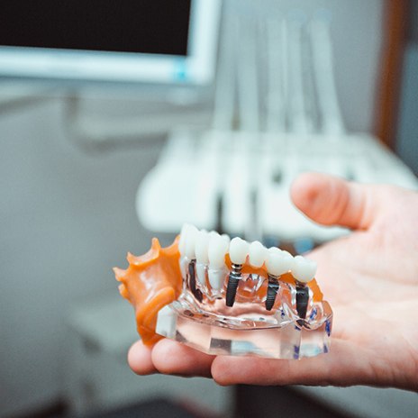 a dentist holding a model of a mouth with dental implants