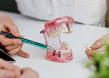 Dentist pointing with pen to implant posts in model jaw with sample dental bridge in other hand