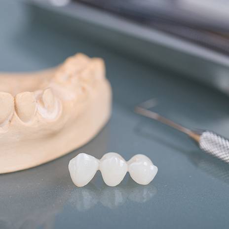Dental bridge next to model jaw and dental instrument on somewhat reflective surface