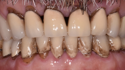 Close up of discolored teeth