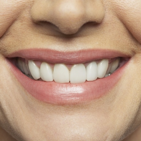 Close up of smile with straight white teeth