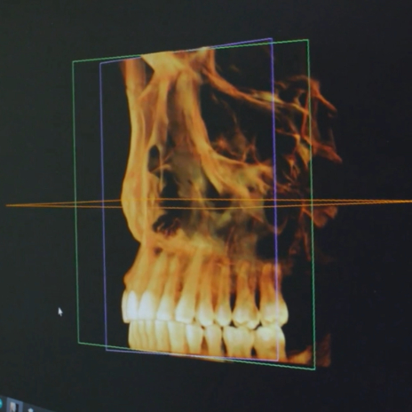 Digital model of teeth and skull