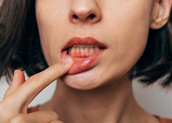 Woman with gum inflammation