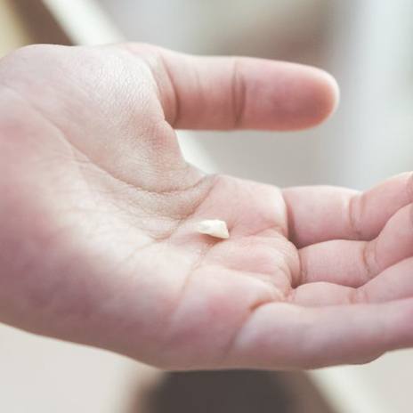 Patient holding a tooth in the palm of their hand