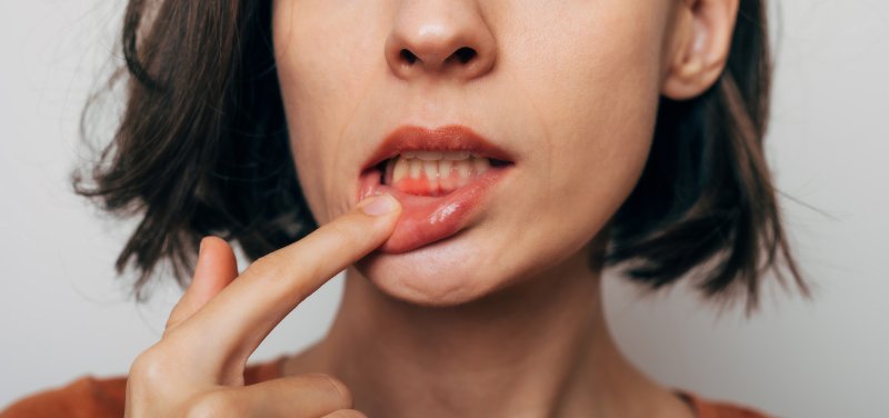 woman with gum disease