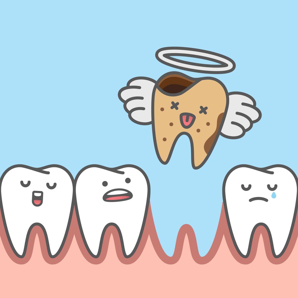 Dead tooth illustration